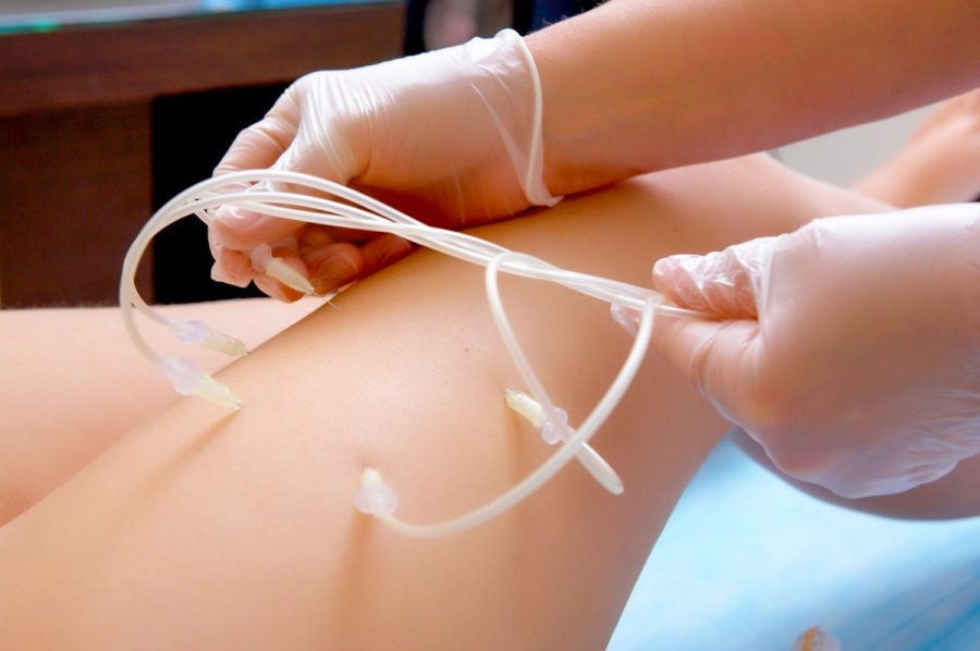 Озонотерапия в санатории - фотография